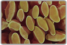 Green Branch Hammer Coral